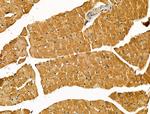 SCN10A Antibody in Immunohistochemistry (Paraffin) (IHC (P))