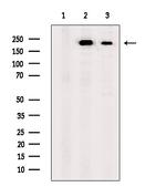 SCN10A Antibody in Western Blot (WB)