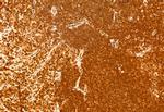 NCOA4 Antibody in Immunohistochemistry (Paraffin) (IHC (P))