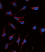 SCF Antibody in Immunocytochemistry (ICC/IF)