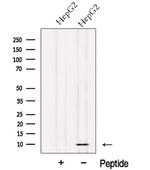 NDUFV3 Antibody in Western Blot (WB)