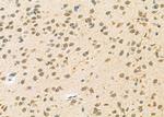 NEUROD4 Antibody in Immunohistochemistry (Paraffin) (IHC (P))