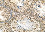 NEUROD4 Antibody in Immunohistochemistry (Paraffin) (IHC (P))