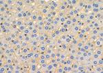 NKTR Antibody in Immunohistochemistry (Paraffin) (IHC (P))