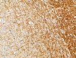 NOD4 Antibody in Immunohistochemistry (Paraffin) (IHC (P))