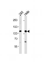 SALL4 Antibody in Western Blot (WB)