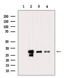 NQO1 Antibody in Western Blot (WB)