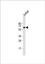 GLUT2 Antibody in Western Blot (WB)