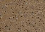 NSUN2 Antibody in Immunohistochemistry (Paraffin) (IHC (P))