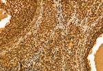 NSUN2 Antibody in Immunohistochemistry (Paraffin) (IHC (P))