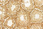 NSUN2 Antibody in Immunohistochemistry (Paraffin) (IHC (P))