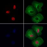 Nucleolin Antibody in Immunocytochemistry (ICC/IF)