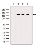 Nucleolin Antibody in Western Blot (WB)