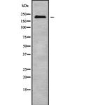 NUP210L Antibody in Western Blot (WB)