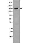 NUP98 Antibody in Western Blot (WB)