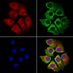 OSBP Antibody in Immunocytochemistry (ICC/IF)