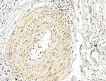 OSBP Antibody in Immunohistochemistry (Paraffin) (IHC (P))