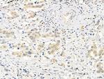 OSBP Antibody in Immunohistochemistry (Paraffin) (IHC (P))