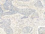 OSBP Antibody in Immunohistochemistry (Paraffin) (IHC (P))