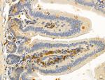 OSBP Antibody in Immunohistochemistry (Paraffin) (IHC (P))