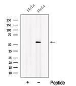 ORP2 Antibody in Western Blot (WB)