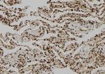 OTUB1 Antibody in Immunohistochemistry (Paraffin) (IHC (P))