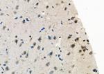 OTX2 Antibody in Immunohistochemistry (Paraffin) (IHC (P))