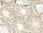 OVOL2 Antibody in Immunohistochemistry (Paraffin) (IHC (P))