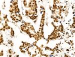 OVOL2 Antibody in Immunohistochemistry (Paraffin) (IHC (P))