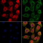 p27 Kip1 Antibody in Immunocytochemistry (ICC/IF)