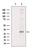 p27 Kip1 Antibody in Western Blot (WB)