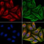 P2Y2 Antibody in Immunocytochemistry (ICC/IF)