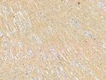 P2X3 Antibody in Immunohistochemistry (Paraffin) (IHC (P))