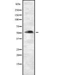 P4HTM Antibody in Western Blot (WB)