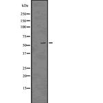 p57 Kip2 Antibody in Western Blot (WB)