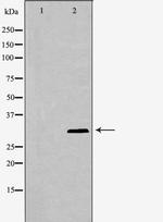 p57 Kip2 Antibody in Western Blot (WB)