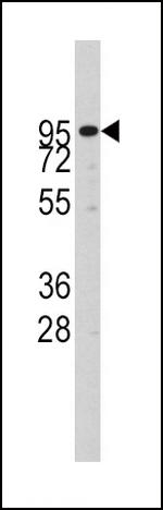 ADAM17 Antibody in Western Blot (WB)