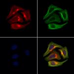 PAPPA2 Antibody in Immunocytochemistry (ICC/IF)