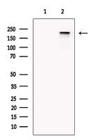 PAPPA2 Antibody in Western Blot (WB)