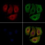 PCSK9 Antibody in Immunocytochemistry (ICC/IF)