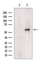 PCSK9 Antibody in Western Blot (WB)