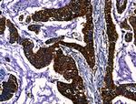 PGAM2 Antibody in Immunohistochemistry (Paraffin) (IHC (P))