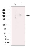 PHF8 Antibody in Western Blot (WB)