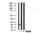 Phospholamban Antibody in Western Blot (WB)