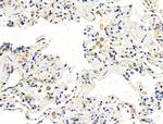 CALM Antibody in Immunohistochemistry (Paraffin) (IHC (P))