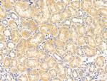 CALM Antibody in Immunohistochemistry (Paraffin) (IHC (P))