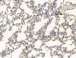 CALM Antibody in Immunohistochemistry (Paraffin) (IHC (P))