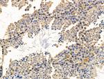 CALM Antibody in Immunohistochemistry (Paraffin) (IHC (P))