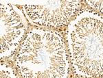 CALM Antibody in Immunohistochemistry (Paraffin) (IHC (P))