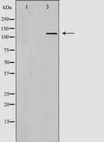 PIK3CB Antibody in Western Blot (WB)